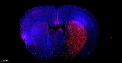 TMR (punainen) Tunel Cell Apoptosis Detection Kit